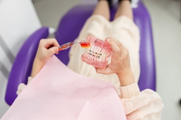 Why Choose Ceramic Braces? Benefits And Considerations